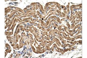 ATP5B antibody was used for immunohistochemistry at a concentration of 4-8 ug/ml. (ATP5B antibody  (N-Term))