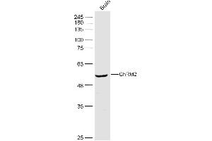 Mouse brain lysates probed with ChRM2 Polyclonal Antibody, Unconjugated  at 1:500 dilution and 4˚C overnight incubation. (Muscarinic Acetylcholine Receptor M2 antibody  (AA 381-466))