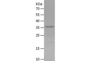 KLRG1 Protein (AA 60-195) (His-IF2DI Tag)