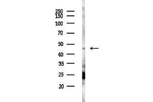 Western blot analysis of lysates from COLO205 cells(starvation 24h treatment), using ADR Antibody at 1/1000 dilution.