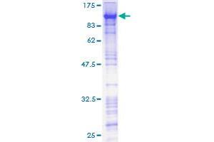 ZNF143 Protein (AA 1-626) (GST tag)