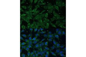 Immunofluorescence analysis of L929 cells using NF-kB p65/RelA antibody (ABIN3016234, ABIN3016235, ABIN3016236 and ABIN6219643) at dilution of 1:100. (NF-kB p65 antibody  (AA 50-180))