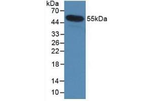 Detection of Recombinant IL35, Human using Monoclonal Antibody to Interleukin 35 (IL35) (Interleukin 35 antibody  (AA 23-219))