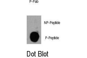 Image no. 1 for anti-Phosphoinositide-3-Kinase, Catalytic, delta Polypeptide (PIK3CD) (pTyr485) antibody (ABIN358424) (PIK3CD antibody  (pTyr485))