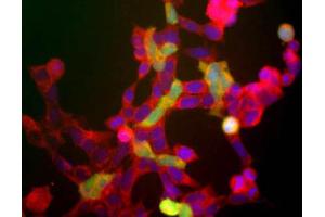 Immunofluorescence Microscopy - Anti-NSE (Neuron specific enolase) antibody.