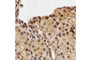 Immunohistochemical analysis of DDB1 staining in human kidney formalin fixed paraffin embedded tissue section. (DDB1 antibody)