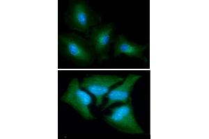 ICC/IF analysis of GOT1 in A549 cells line, stained with DAPI (Blue) for nucleus staining and monoclonal anti-human GOT1 antibody (1:100) with goat anti-mouse IgG-Alexa fluor 488 conjugate (Green). (GOT1 antibody  (AA 1-413))