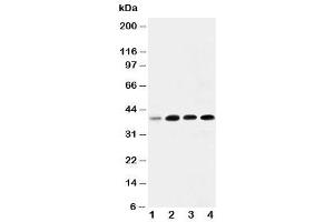 Western blot testing of IGFBP3 antibody and Lane 1:  293T (IGFBP3 antibody  (Middle Region))