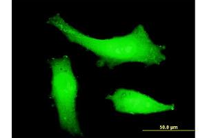 Immunofluorescence of monoclonal antibody to ITCH on HeLa cell. (ITCH antibody  (AA 92-190))