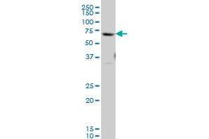 GATAD2B monoclonal antibody (M02), clone 4C4 Western Blot analysis of GATAD2B expression in Jurkat . (GATAD2B antibody  (AA 3-110))