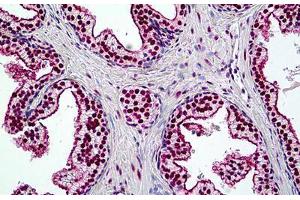 Human Prostate: Formalin-Fixed, Paraffin-Embedded (FFPE) (SMARCA4 antibody  (AA 2-14))