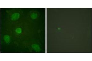 Immunofluorescence analysis of HeLa cells, using Hic-5 (Ab-60) Antibody. (TGFB1I1 antibody  (AA 31-80))