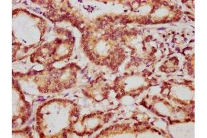 Immunohistochemistry (IHC) image for anti-14-3-3 epsilon (YWHAE) (AA 1-255) antibody (ABIN7142087)