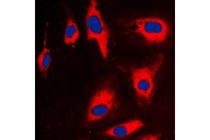 Immunofluorescent analysis of TCTP staining in CCRFCEM cells. (TPT1 antibody  (Center))