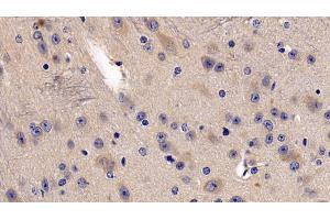 Detection of DDAH2 in Mouse Cerebrum Tissue using Polyclonal Antibody to Dimethylarginine Dimethylaminohydrolase 2 (DDAH2)