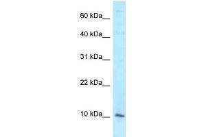WB Suggested Anti-DAP Antibody Titration: 1. (DAP antibody  (Middle Region))