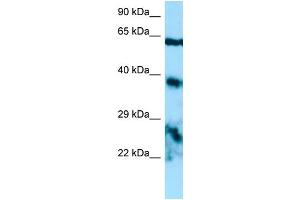 WB Suggested Anti-EPYC Antibody Titration: 1. (EPYC antibody  (Middle Region))