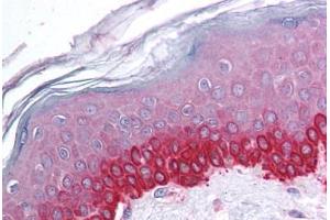 Human Skin (formalin-fixed, paraffin-embedded) stained with CTCF antibody ABIN214093 at 5 ug/ml followed by biotinylated goat anti-rabbit IgG secondary antibody ABIN481713, alkaline phosphatase-streptavidin and chromogen. (CTCF antibody  (N-Term))