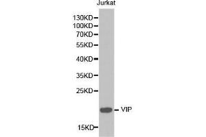 Western blot analysis of extracts of Jurkat cell lines, using VIP antibody. (Vip antibody  (AA 31-170))