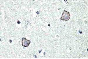 Image no. 2 for anti-Lysophosphatidic Acid Receptor 1 (LPAR1) antibody (ABIN317688) (LPAR1 antibody)