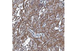 IHC analysis of EHD3 using anti-EHD3 antibody (ABIN7602777). (EHD3 antibody  (C-Term))
