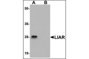 Western blot analysis of LIAR in mouse kidney tissue lysate with this product at 1 μg/ml in (A) the absence and (B) the presence of blocking peptide.