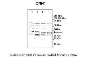 Lanes:   1. (CNN1 antibody  (N-Term))
