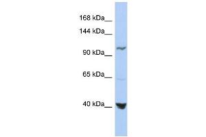 WB Suggested Anti-MTHFD1 Antibody Titration:  0. (MTHFD1 antibody  (Middle Region))