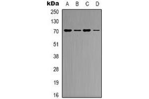 Western blot analysis of KEAP1 expression in K562 (A), Hela (B), mouse heart (C), mouse brain (D) whole cell lysates. (KEAP1 antibody)