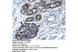 Human kidney (GABPA antibody  (C-Term))