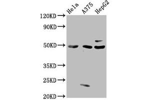 Western Blot Positive WB detected in: Hela whole cell lysate, A375 whole cell lysate, HepG2 whole cell lysate All lanes: STK24 antibody at 3 μg/mL Secondary Goat polyclonal to rabbit IgG at 1/50000 dilution Predicted band size: 50, 48 kDa Observed band size: 50 kDa (STK24 antibody  (AA 1-431))
