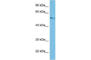 Host:  Rabbit  Target Name:  SGSH  Sample Tissue:  Human THP-1 Whole Cell  Antibody Dilution:  1ug/ml (SGSH antibody  (N-Term))