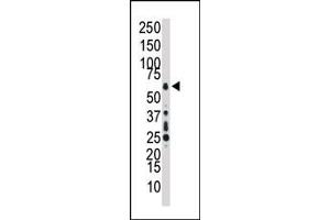 Western blot analysis of anti-TAK1 Pab (ABIN392466 and ABIN2842053) in HL60 cell lysate. (TR4 antibody  (C-Term))