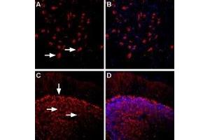 Expression of β1-Adrenoceptor in rat and mouse brain - Immunohistochemical staining of rat dorsal raphe nucleus and mouse cerebellum using Anti-β1-Adrenergic Receptor (extracellular) Antibody (ABIN7042902, ABIN7043924 and ABIN7043925), (1:400). (ADRB1 antibody  (2nd Extracellular Loop))