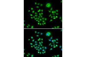 Immunofluorescence (IF) image for anti-HIV-1 Rev Binding Protein (HRB) antibody (ABIN1980310) (AGFG1 antibody)