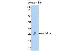 Western Blotting (WB) image for anti-Complement Factor P (CFP) (AA 310-459) antibody (ABIN1173602) (CFP antibody  (AA 310-459))