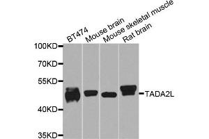 Western blot analysis of extracts of various cells, using TADA2A antibody. (TADA2L antibody)
