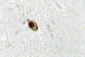Immunohistochemistry (IHC) analyzes of Zic1/2/3 antibody in paraffin-embedded human brain tissue. (ZIC1 antibody)
