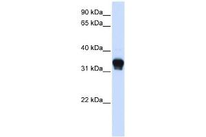 CK1 alpha 1 antibody used at 1 ug/ml to detect target protein. (CK1 alpha 1 (C-Term) antibody)