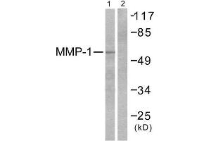 Western Blotting (WB) image for anti-Matrix Metallopeptidase 1 (Interstitial Collagenase) (MMP1) (C-Term) antibody (ABIN1848669) (MMP1 antibody  (C-Term))