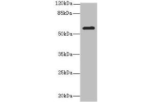Western blot All lanes: MMP19antibody at 2. (MMP19 antibody  (AA 209-508))