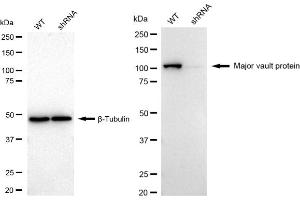 Western blotting analysis using Major Vault Protein antibody (ABIN7799325).