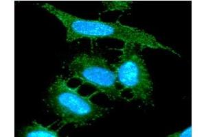 anti-Cytochrome C Oxidase Subunit Va (COX5A) (AA 42-150) antibody