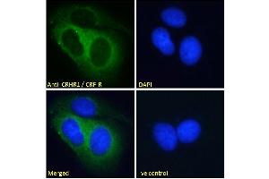ABIN190893 Immunofluorescence analysis of paraformaldehyde fixed MCF7 cells, permeabilized with 0. (CRHR1 antibody  (AA 250-263))
