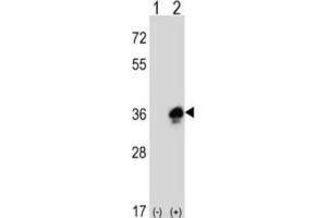 Western Blotting (WB) image for anti-Myelin Protein Zero (MPZ) antibody (ABIN3003838) (MPZ antibody)