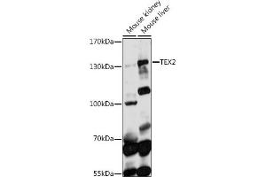 Western blot analysis of extracts of various cell lines, using TEX2 antibody (ABIN7270775) at 1:1000 dilution. (TEX2 antibody  (AA 915-1134))