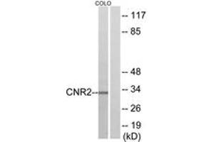 Western blot analysis of extracts from COLO205 cells, using CNR2 Antibody. (CNR2 antibody  (AA 191-240))