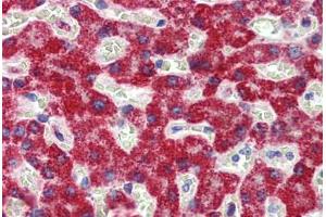 Liver, Human: Formalin-Fixed, Paraffin-Embedded (FFPE) (SH3BP2 antibody  (AA 432-481))