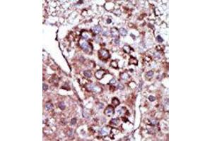 Image no. 2 for anti-Diacylglycerol Kinase, zeta (DGKZ) (C-Term) antibody (ABIN360519) (DGKZ antibody  (C-Term))