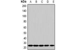 Western blot analysis of RPS5 expression in Hela (A), HepG2 (B), Jurkat (C), mouse spleen (D), mouse lung (E) whole cell lysates.
